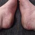 Solez (@footprofan1) Twitter profile photo Solez (@footprofan1) Twitter profile photo