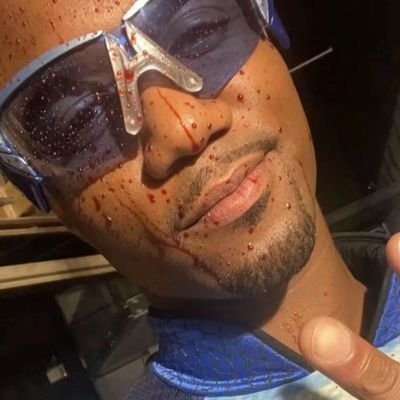 9NageJEAsT69353's profile picture. ##X-9hOPnS7iOgc2j6##￥mOgj3dzPpOc￥:// MF7997