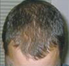 Belmont Hair Clinic