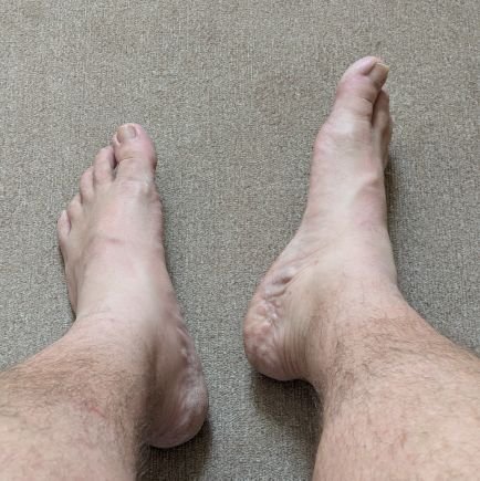 Size 11 UK based gay Irish Dom Daddy Bear, 40y/o, 140kg, 180cm. Love having my feet worshipped, cleaned, eaten, massaged & admired. DM to buy personalised stuff