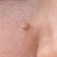 Blake Lively’s Mole (@blakelivelymole) 's Twitter Profile