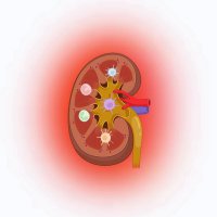 Hypertension and Kidney Immunology Lab (@labhypertension) 's Twitter Profile Photo Hypertension and Kidney Immunology Lab (@labhypertension) 's Twitter Profile Photo