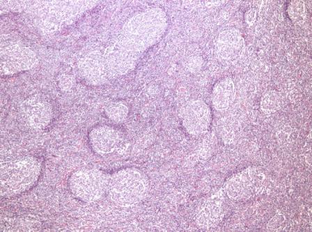 This Twitter is dedicated to human pathology and maintained by @javiermunoz67
