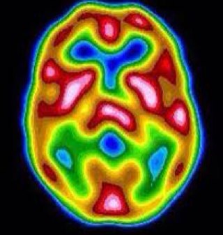 onmymindairdrie's profile picture. 