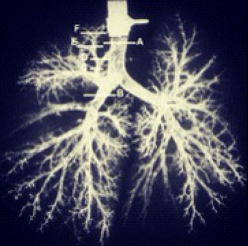 @RespiratoryTree