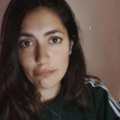 cheluvera's profile picture. 🐶🐶🐶 y moretones