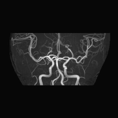 Percheron_E's profile picture. どこか地方の脳外科医
久々復活しました