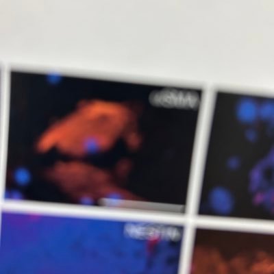 学部二回生|理研 脳神経科学研究センター 脳科学塾2025 正規生|Biohybridrobotics|Neuroscience|Brain Machine Interface|Kaggler (08/2025~) 🥇0 🥈0 🥉1