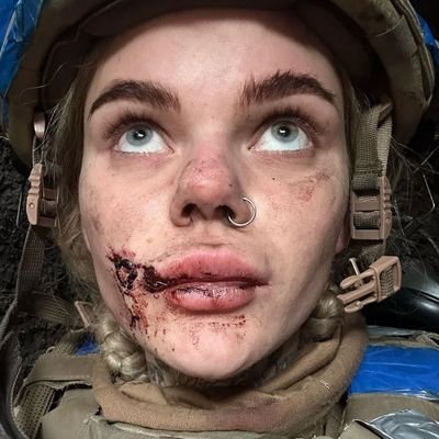 🇺🇦 Гордий український громадянин Волонтерствую та захищаю материнську землю наступально славу України 🇺🇦🇺🇦