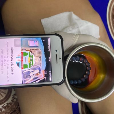 Cắt bao quy đầu bằng máy tận nơi riêng tư kín đáo ZL:0787807628. Không có nhu cầu xin đừng kb Zalo nhé