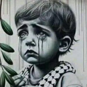 I am Islam from Gaza. I am collecting donations for my son who was injured in the Israeli bombing of our house