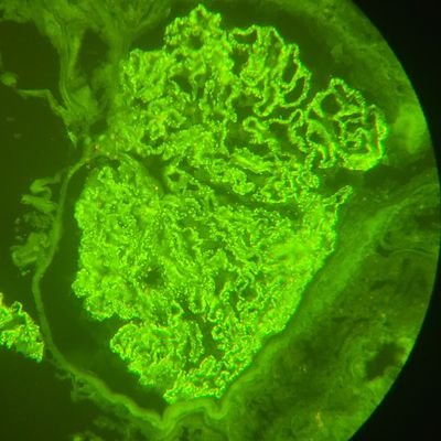 mejia_nancy's profile picture. Patóloga.