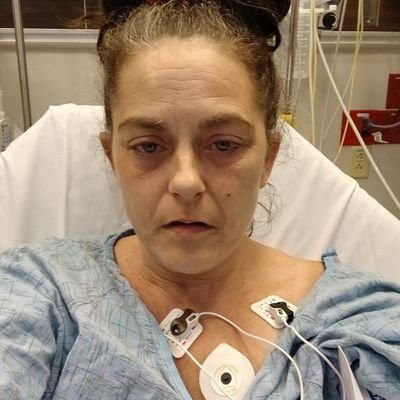 AliR2024138459's profile picture. I am at 40 four-year-old woman.
I have done.What are the medical issues My entire life... They are just sick and tired of being Sick & Tired 😫PRAY'n4EVERYONE