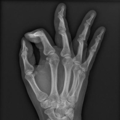 vik_toh_'s profile picture. SLA | Student Radiographer☢️ | GGMU❤️