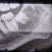 Patologo_Maxilofacial (@ma91884patologo) Twitter profile photo Patologo_Maxilofacial (@ma91884patologo) Twitter profile photo