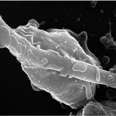 Regulation of inflammation and immunity during infection and disease. Interested in neutrophils, NETs extracellular chromatin, CVDs and anti-fungal immunity.