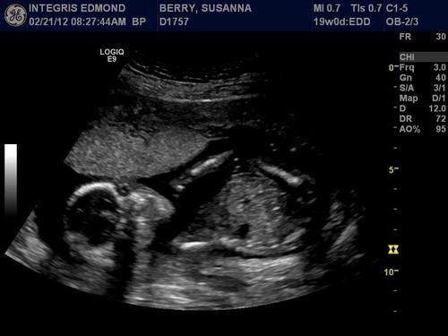 Annabelle_Berry's profile picture. “I knew you before I formed you in your mother’s womb. Before you were born I set you apart and appointed you a Prophet to the nations. http://t.co/9eBw2cQF