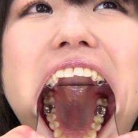 歯フェチ (@teethfe) 's Twitter Profile Photo 歯フェチ (@teethfe) 's Twitter Profile Photo