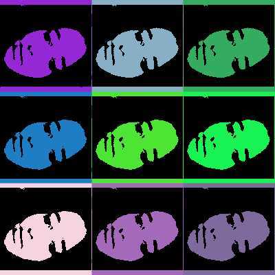 lidipinedo's profile picture. TSIDMN ☢️TSAPC 🔬. Descubriendo el mundo de la investigación de la neurociencia🧠. Animadora del cj la balsa. Neska de Galtzagorri. Me encanta patinar🛼.