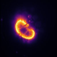 Nephron Study Circle (@nephstudycircle) 's Twitter Profile