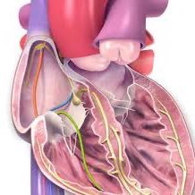 EPMemes339508's profile picture. views are not my own #EPeeps #Electrophysiology