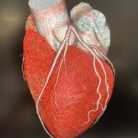 RyC Imagen Cardio (@rycimagencardio) 's Twitter Profile Photo RyC Imagen Cardio (@rycimagencardio) 's Twitter Profile Photo