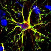 Neuroimmunomics Lab (@neuroimmunomics) 's Twitter Profile Photo Neuroimmunomics Lab (@neuroimmunomics) 's Twitter Profile Photo