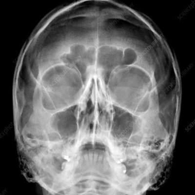 TwoWolvesFight's profile picture. 