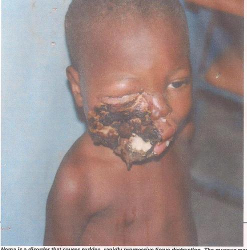 Malawifoundatio's profile picture. Charity and Donors organization