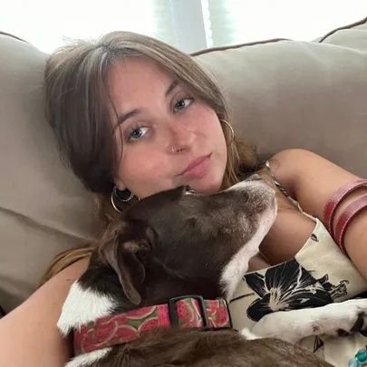 19 years -old Liv Blymer bravely battles cancer again, facing liver cancer after overcoming ovarian cancer