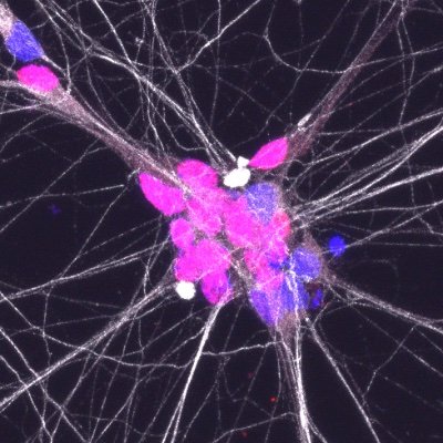 MNDOxford's profile picture. Oxford MND/ALS Research Groups at @NDCNOxford and @KavliOxford

Researching MND/ALS through early disease modeling and biomarker discovery