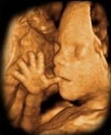 The 16th Philadelphia Prenatal Diagnosis, OB/MFM, Fetal ECHO & OB Ultrasound Conference June 6 until December 31st , 2024