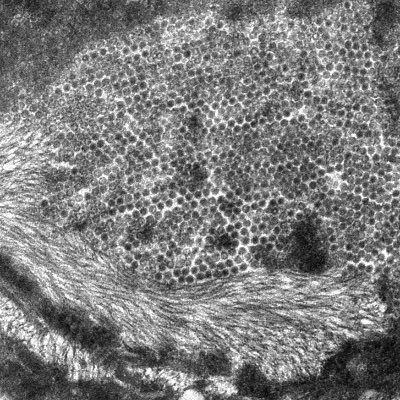 Virologist (Papillomavirus)
主食・おかず・おやつにPapillomavirus
パピローマウイルスに関することならなんでも
https://t.co/sSdtqb1DhP