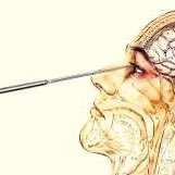 mrpagestudent2's profile picture. 55 year old - Ex North Korean Military - Lobotomized                  .... . .-.. .--.