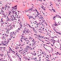 UofG Cancer Sciences (@uofgcancersci) 's Twitter Profile