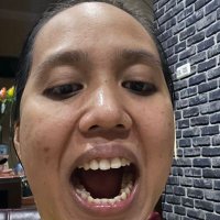 dokter gigi lumajang puspa mahameru (@puspanarendram) 's Twitter Profile