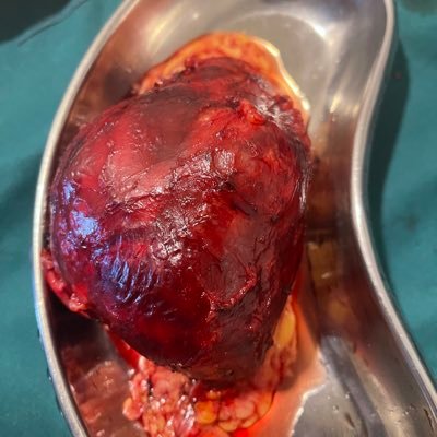 surgeonmushtaq's profile picture. General Surgeon, Urologist and Renal transplant surgeon