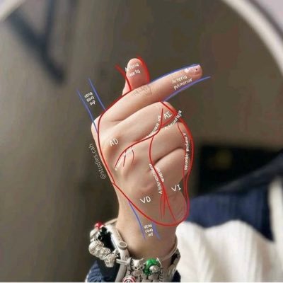 I am resident of Radiodiagnosis PGY2 here share some good cases please follow