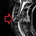 Spinal Cord Awareness & Research (@helpscivictims) Twitter profile photo Spinal Cord Awareness & Research (@helpscivictims) Twitter profile photo