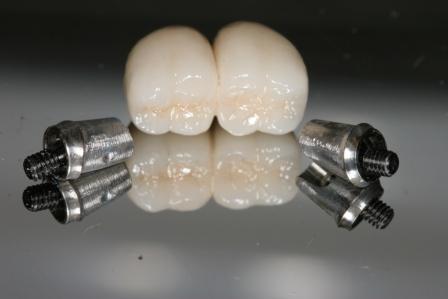 Prosthodontics1's profile picture. We solve complex dental problems!  Dental Implants, Veneers, Crown and Bridge, Dentures, TMD, Maxillofacial