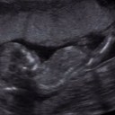 Betsy Berry - @Prayforbetsy - Twitter