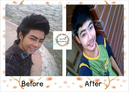 ErosGluta's profile picture. สนใจ สินค้า ติดต่อได้ที่ 0889307037