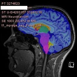 CatharianDuke's profile picture. late medieval spirit, adhd body