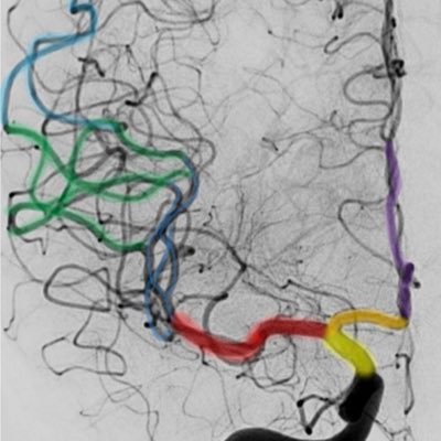 EndoVascular NeuroRadiology fellow|Doctrine of Nerves|Indian expat|Amateur chef|Global citizen. Tweets not medical advice. 🇮🇳 🇺🇸