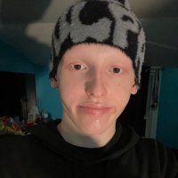 TheHairlessWonder (@thairlesswonder) 's Twitter Profile Photo TheHairlessWonder (@thairlesswonder) 's Twitter Profile Photo