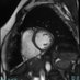 Cardiovascular MRI Takeaway (@cmrtakeaway) Twitter profile photo Cardiovascular MRI Takeaway (@cmrtakeaway) Twitter profile photo