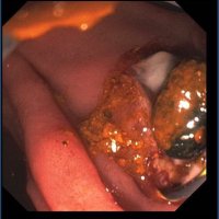 dr alex lake (@dralexgastro) 's Twitter Profile