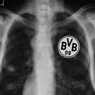 e_AC007's profile picture. Football, Politics, News, Memes and BVB🖤💛