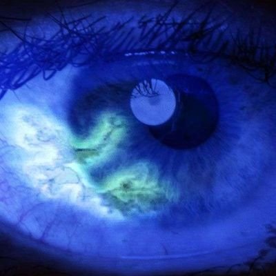 °Astralago; Un Médico disléxico 🩺
°Also sprach Zarathustra ~ 🎶