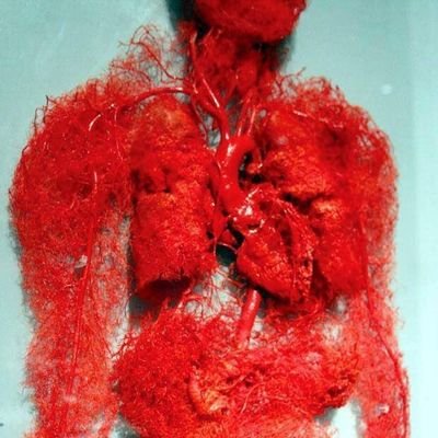 Life lost back in 2022.
#MECFS
#LongCovid
#PostVac
#NotRecovered
#MillionsMissing
https://t.co/VVu3MaZ2y9